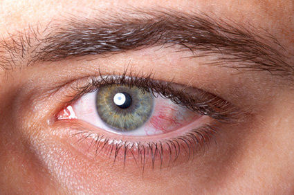 A presen&ccedil;a de sangue nos olhos