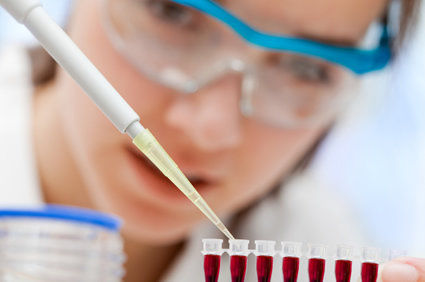 Anticorpos anti-SARS-COV-2 (COVID-19)
