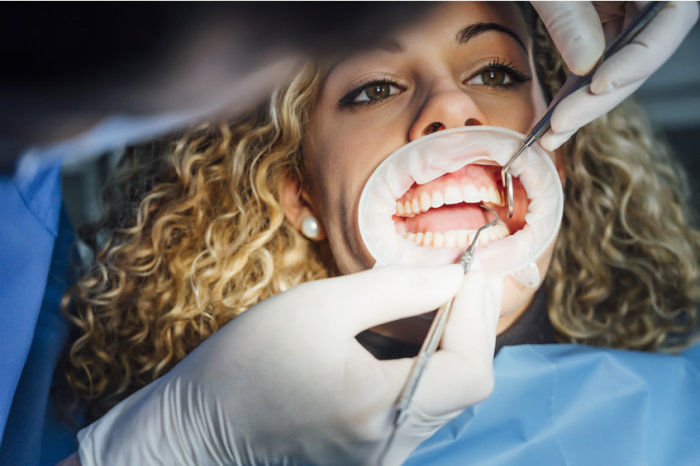 Dentes do siso: qual &eacute; a quest&atilde;o?