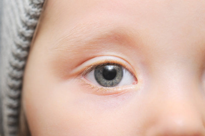 Diferen&ccedil;as entre Oftalmologia, Optometria e Ort&oacute;ptica