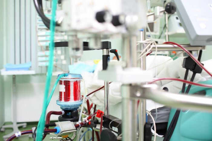 O que &eacute; ECMO e seu uso no tratamento da Covid-19