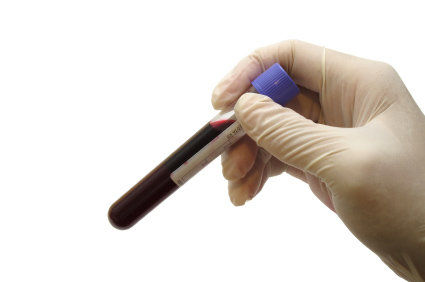 Em que consiste a gasometria arterial? Quando deve ser feita?