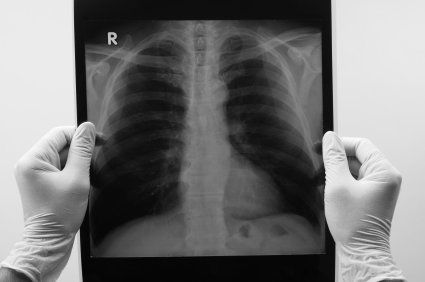 Fisioterapia respiratória