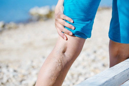 Flebite: conceito, causas, sintomas, diagn&oacute;stico, tratamento, preven&ccedil;&atilde;o e complica&ccedil;&otilde;es