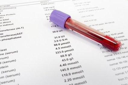 Hemossiderose: quando o ferro em excesso pode comprometer pulm&otilde;es, f&iacute;gado e cora&ccedil;&atilde;o