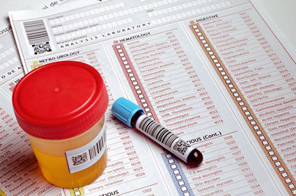 Hiperamonemia: conhe&ccedil;a essa doen&ccedil;a metab&oacute;lica