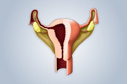 Histerectomia ou retirada do &uacute;tero: o que &eacute;? Quem deve fazer? Quais s&atilde;o os riscos? Como evolui?