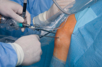 Laparoscopia: o que &eacute;? Como &eacute;? Quais s&atilde;o as desvantagens e os riscos?