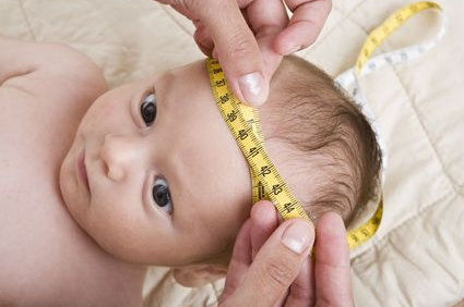 Microcefalia: conceito, causas, sintomas, diagn&oacute;stico, tratamento, preven&ccedil;&otilde;es, poss&iacute;veis complica&ccedil;&otilde;es