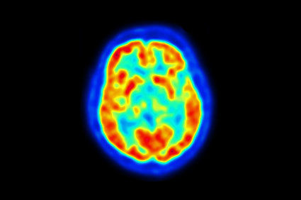 PET Scan: o que &eacute;? Por que fazer? Como &eacute; feita? Quem deve e quem n&atilde;o deve fazer? Quais s&atilde;o as poss&iacute;veis complica&ccedil;&otilde;es?