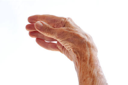 Por que meus dedos est&atilde;o ficando tortos e doloridos? Pode ser artrose? Conhe&ccedil;a esta condi&ccedil;&atilde;o e ajude a preveni-la 