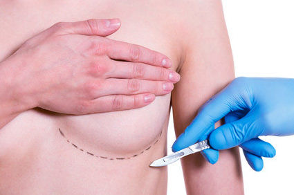Pr&oacute;tese da mama ou Mamoplastia