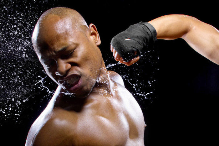 Quadro neurol&oacute;gico tardio dos lutadores de boxe