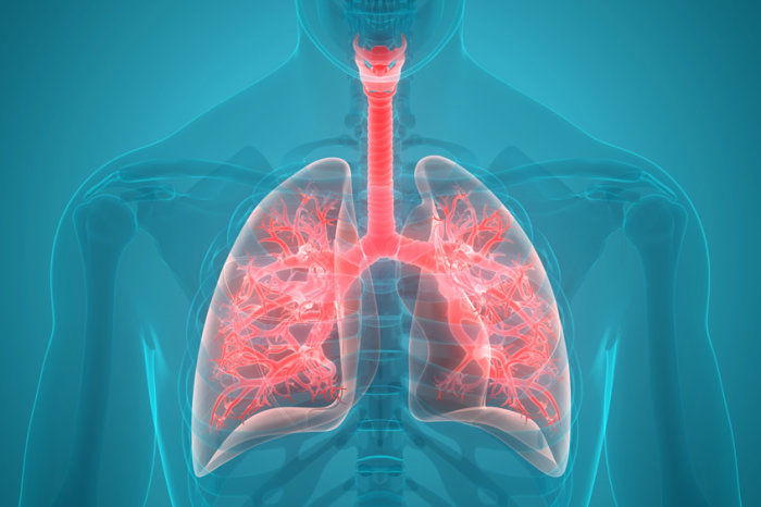 Quando pensar em pneumonia at&iacute;pica?