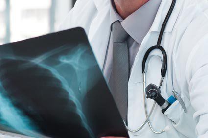 Siderose pulmonar: como ela &eacute;?