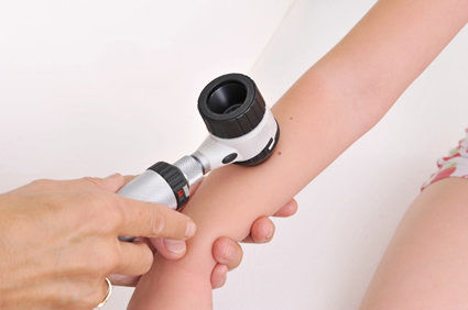Telangiectasia cong&ecirc;nita: conceito, causas, sintomas, diagn&oacute;stico, tratamento, evolu&ccedil;&atilde;o