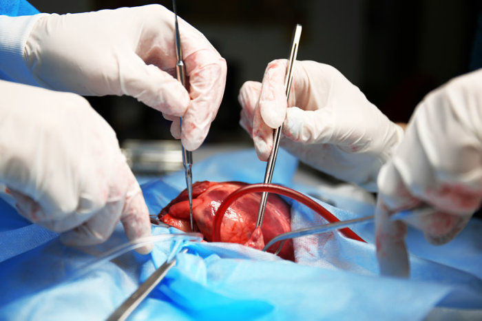 Transplante card&iacute;aco