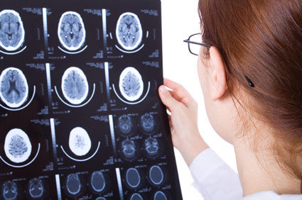 Tratamento cir&uacute;rgico da epilepsia