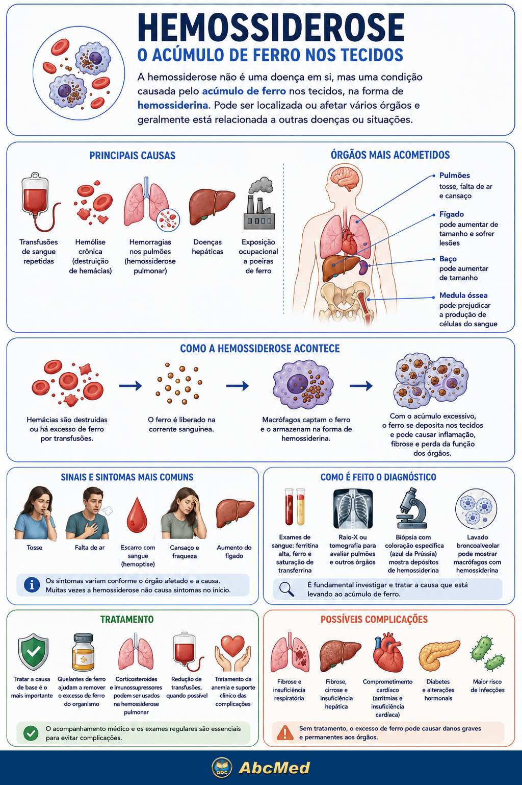 Infográfico - Hemossiderose Infográfico - Hemossiderose