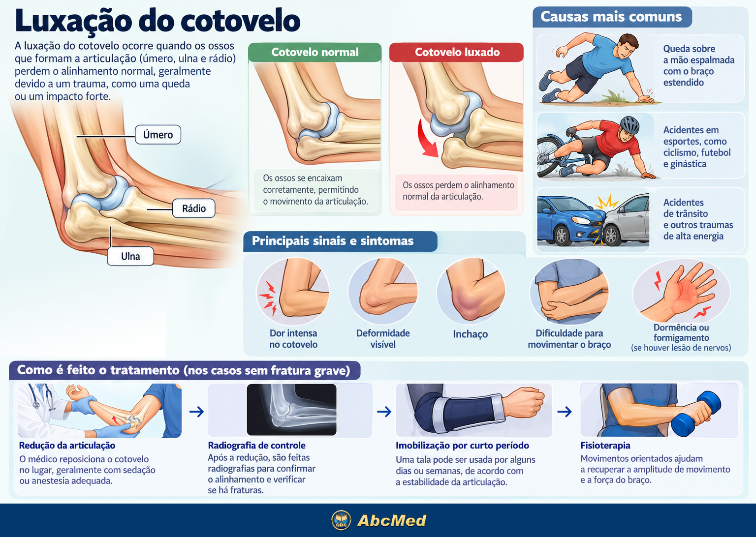 Infográfico - Luxação do cotovelo
