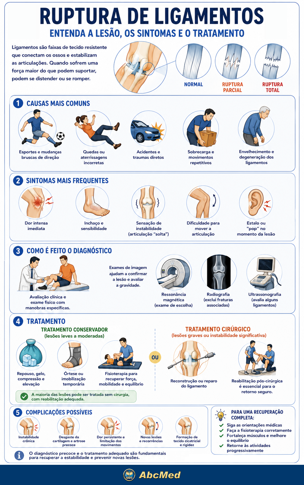Infográfico - Ruptura de ligamentos Infográfico - Ruptura de ligamentos