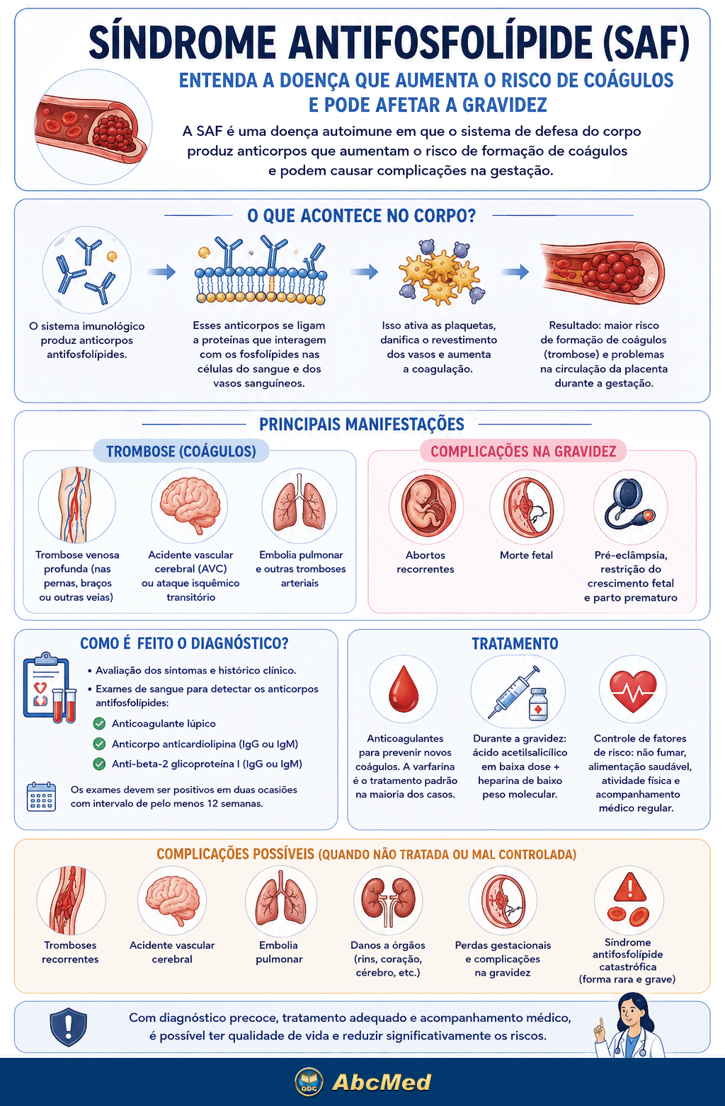 Infográfico Síndrome Antifosfolípide Infográfico Síndrome Antifosfolípide