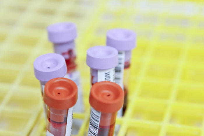 Anemia infantil - quais são as características e o que pode ser feito?