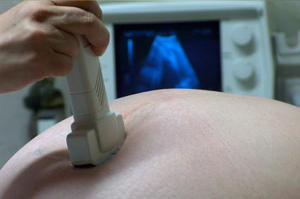 Parto vaginal - como é?