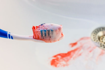 Sangramento das gengivas - tem como evitar!